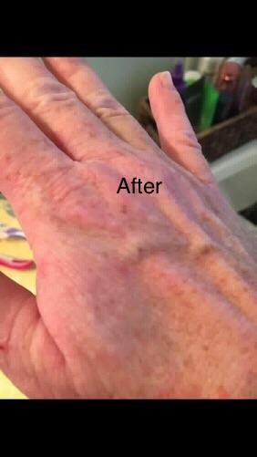 “No More Eczema” Organic Soap Bar – Gentle Unscented Cleanser for Sensitive Skin